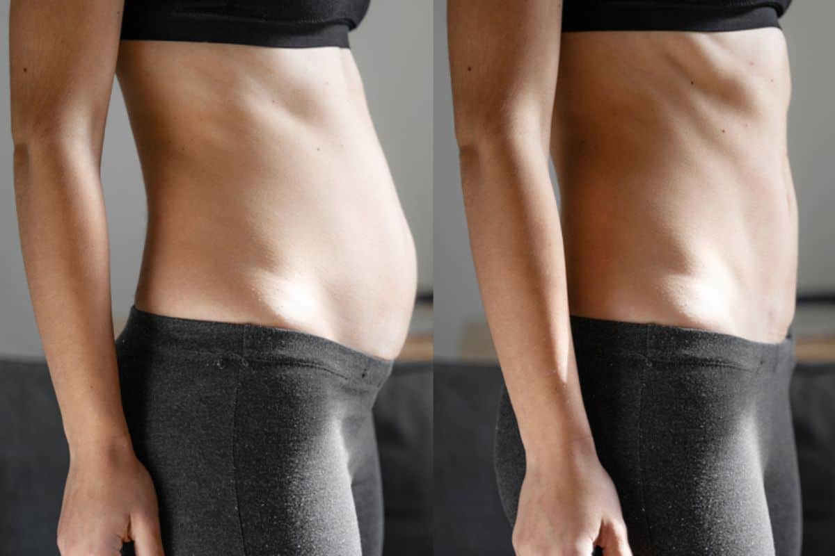 Post-Pregnancy: What Happens to Your Abdominal Muscles After Birth Peterborough