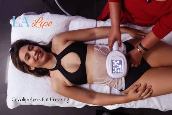 woman getting cryolipolysis Peterborough
