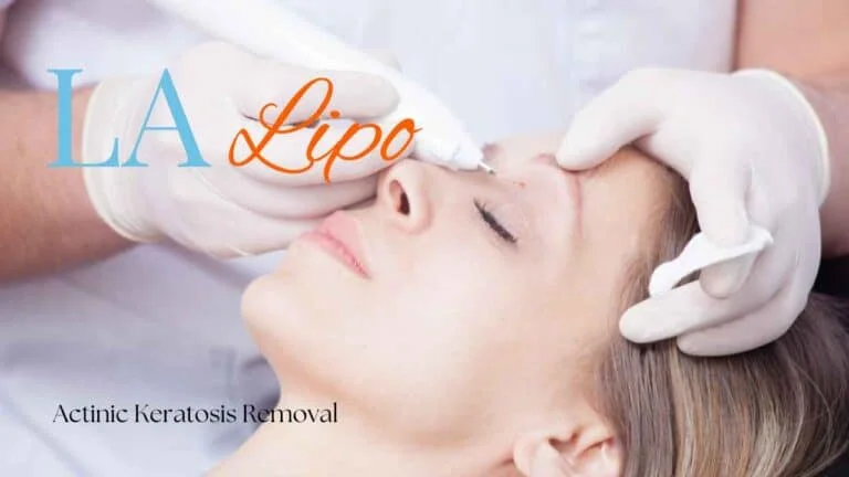 Woman receiving Actinic Keratosis Removal Treatment Peterborough