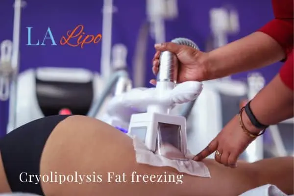 women getting fat freezing Peterborough