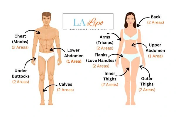 LA LIPO Cryolipolysis Areas Peterborough