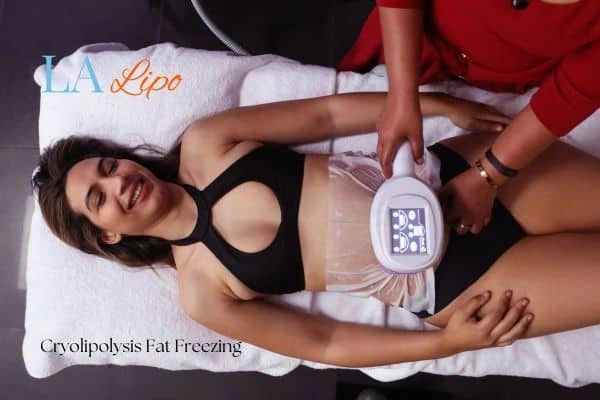 woman getting cryolipolysis Peterborough