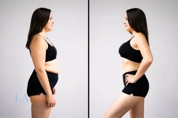 link between body image and mental health Peterborough