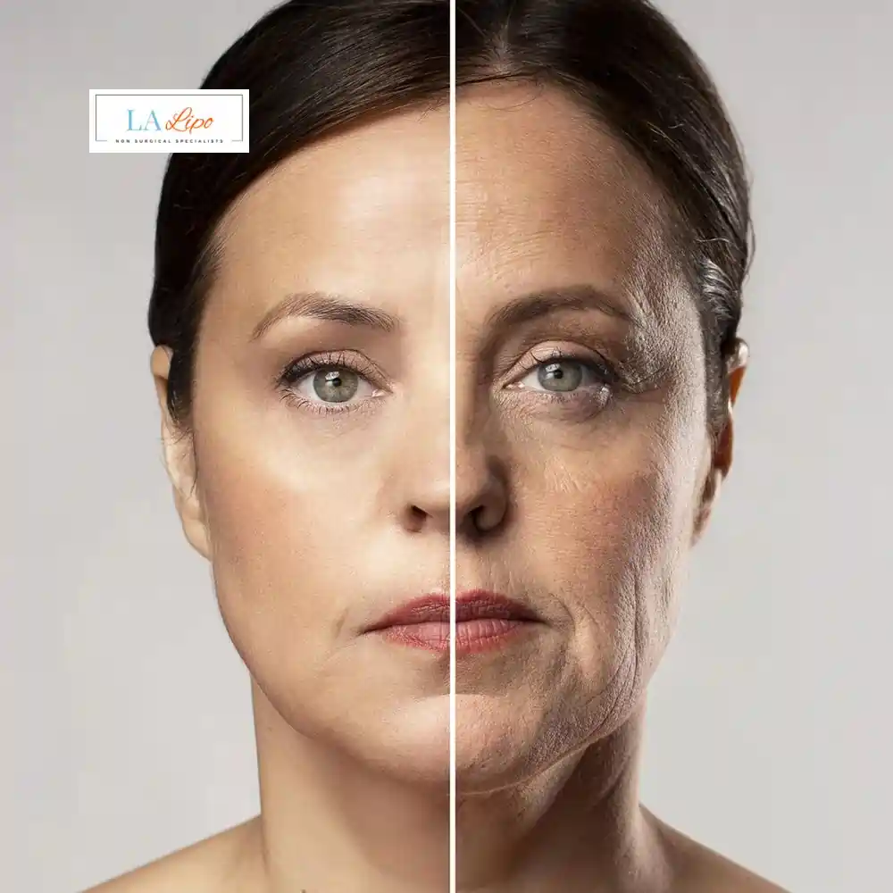 How Can You Tell If Non-Surgical Skin Tightening Is Right for You Peterborough?