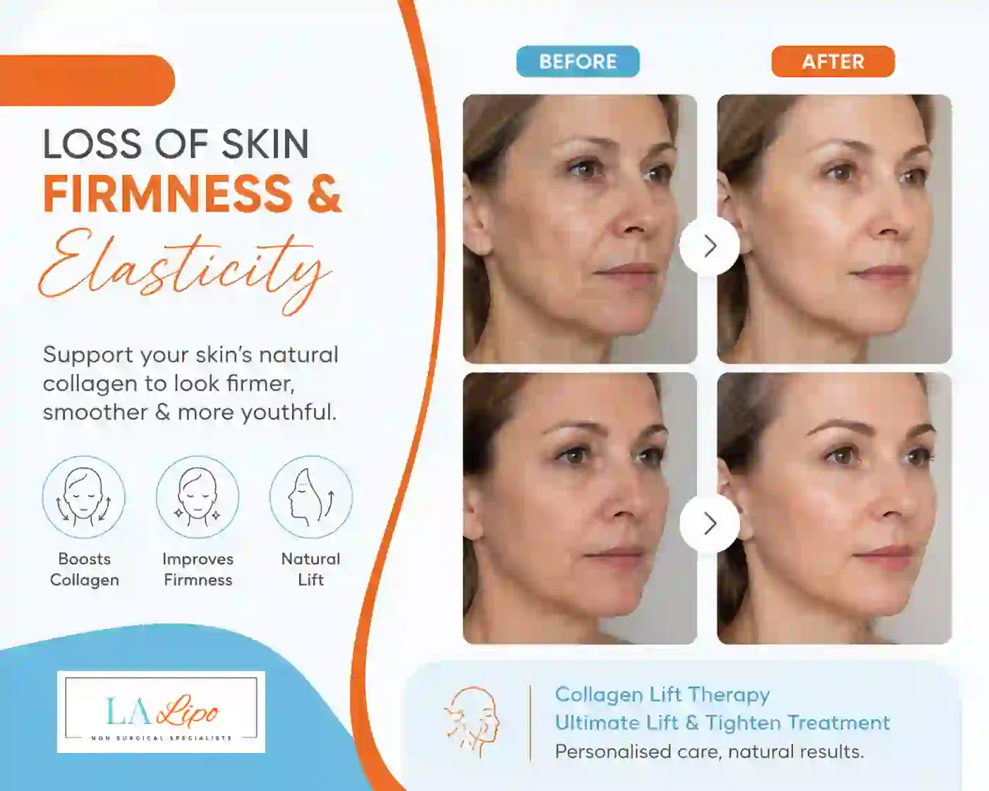 Sign #7: Loss of Skin Firmness and Elasticity Peterborough